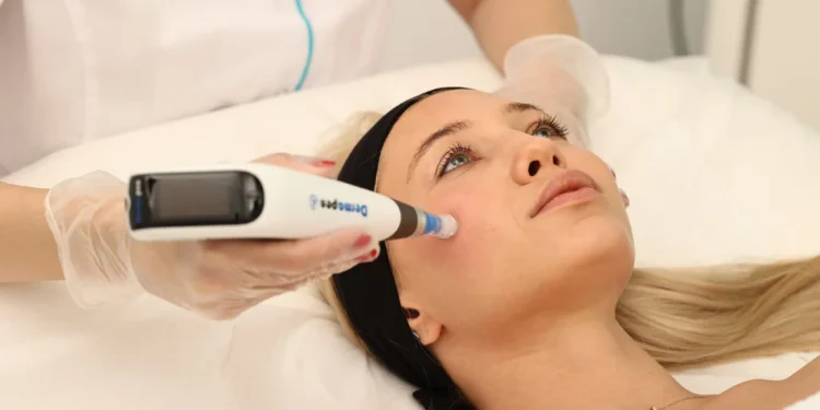 Microneedling cu Dermapen™: Cum funcționează și de ce este atât de popular